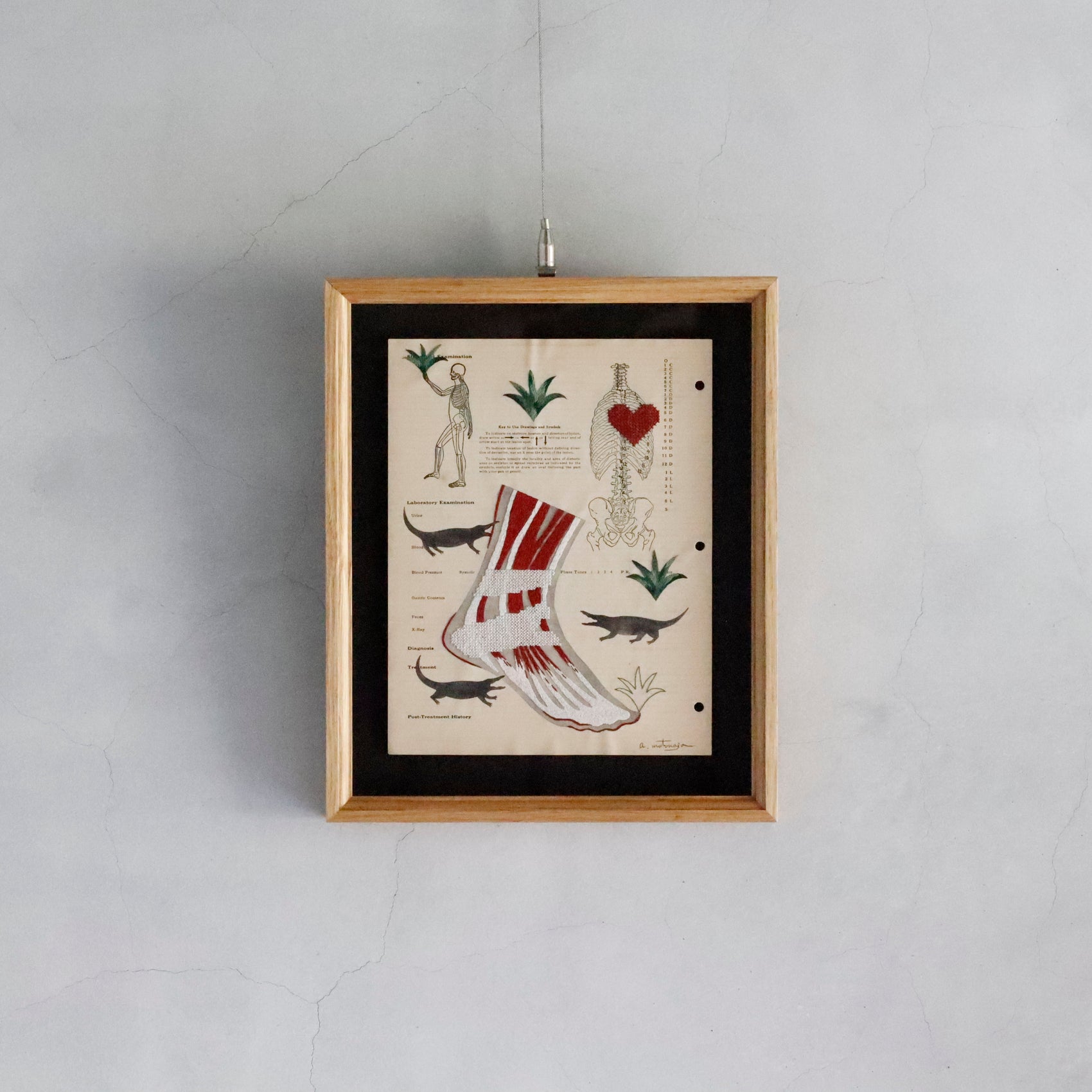 Ayako Motonaga | Foot anatomy